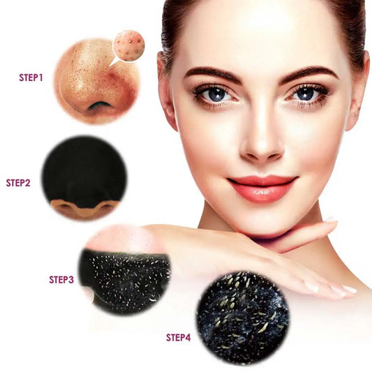 10Pcs Nose Blackhead Remover Mask